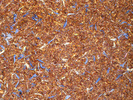 Rooibos Waldbeere